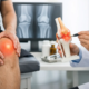 Tratamiento para artrosis de rodilla eficaz