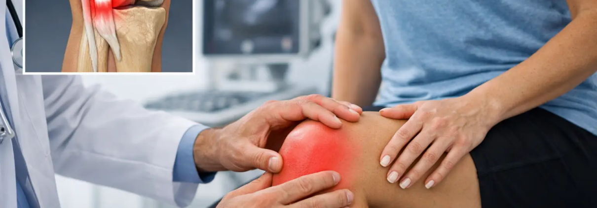 Cómo desinflamar un tendón de la rodilla