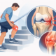 Desgaste de rótula y dolor al subir escaleras