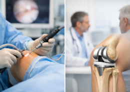¿Artroscopia o prótesis de rodilla según tu caso?