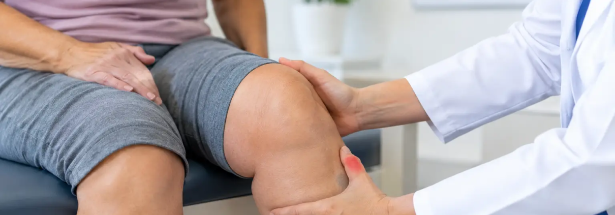 Qué indica la hinchazón persistente en la rodilla