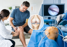¿Artroscopia frente a tratamiento conservador?
