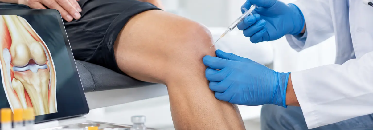 PRP frente a infiltración hialurónica de rodilla