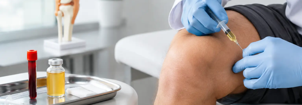 PRP versus corticoides en dolor de rodilla